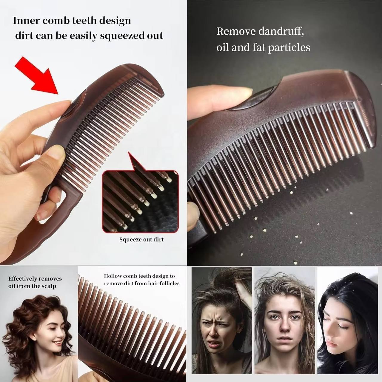 Pack Of 2 Dandruff Removal Comb | Nits Removal Comb | Lice comb | Dandruff Comb Energy Massager Comb | Hair Dressing Comb | Kangi For Hair Growth | Anti-Dandruff Massage Comb | Dandruff Painless Comb | Pack of 2